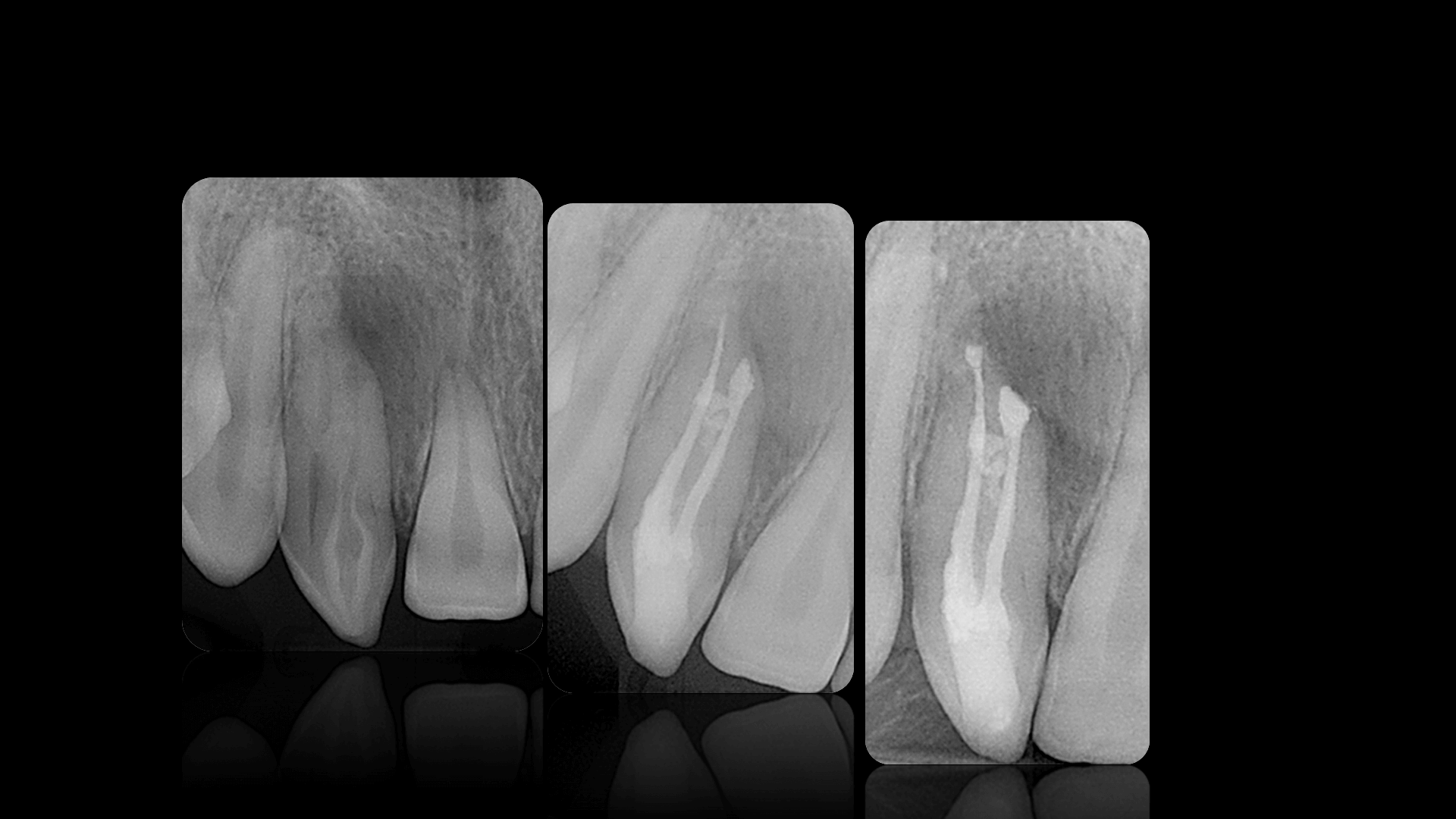 Complex Anatomy - Case 17
